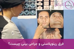 فرق رینوپلاستی و جراحی بینی