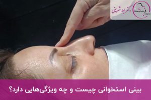بینی استخوانی چیست