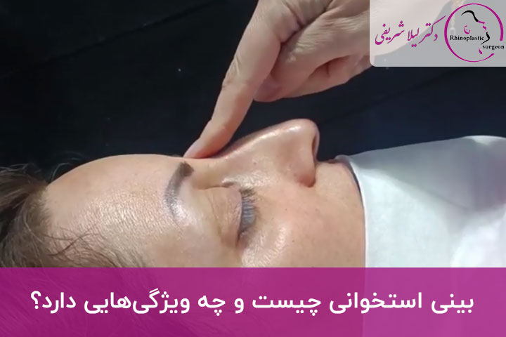بینی استخوانی چیست