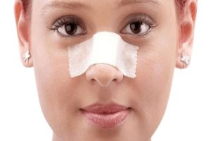 طریقه چسب زدن بینی گوشتی