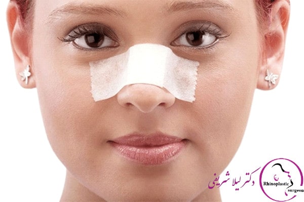 سن مناسب عمل بینی