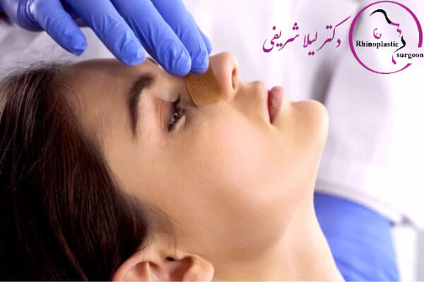 دراز نشست و رینوپلاستی