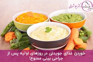 تا چند روز بعد عمل بینی نباید غذای جویدنی خورد