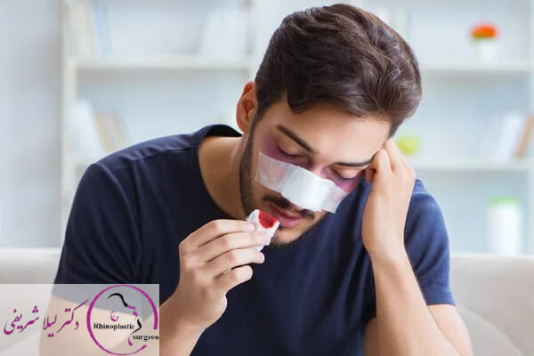 درد و خونریزی بعد از عمل بینی