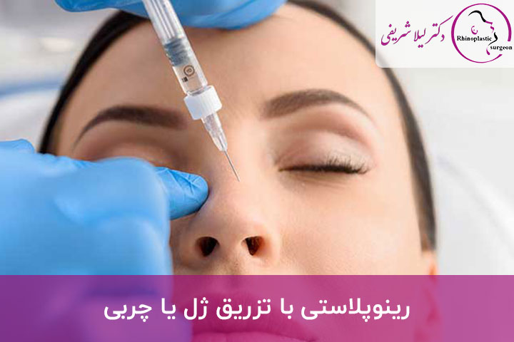 رینوپلاستی بینی بدون جراحی