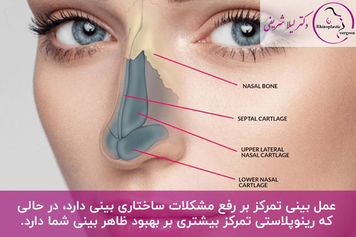 فرق رینوپلاستی و جراحی بینی