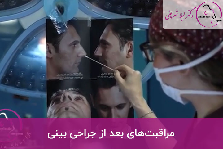 مراقبتهای بعد از عمل بینی استخوانی