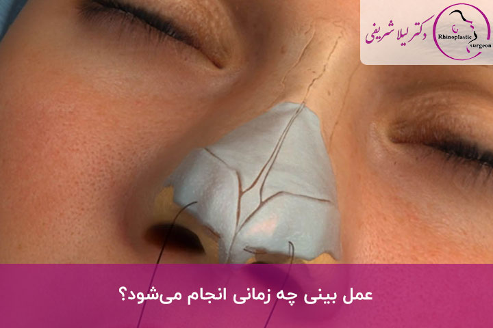 عمل بینی چیست