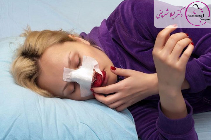 توصیه های بعد از عمل بینی