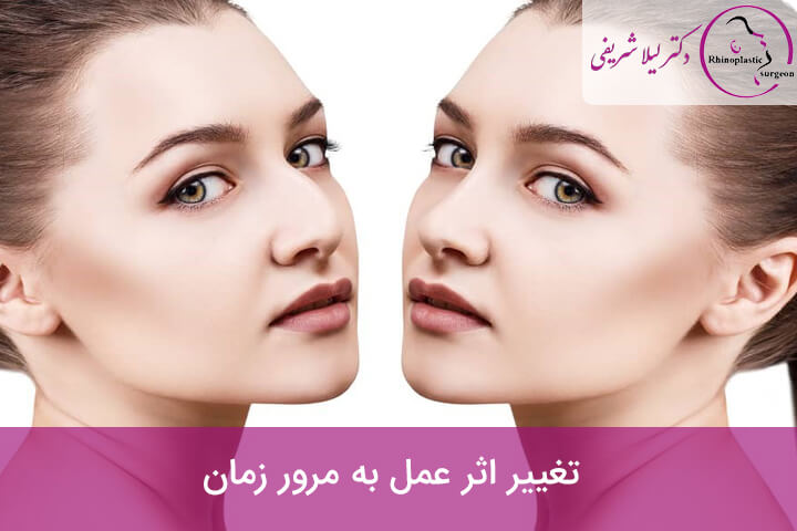 تغییر اثر عمل به مرور زمان