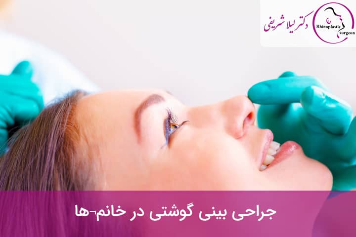 جراحی بینی گوشتی در خانم ها
