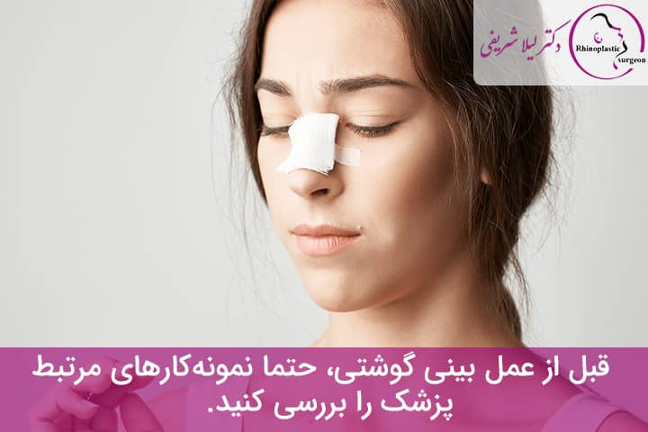 جراحی بینی گوشتی