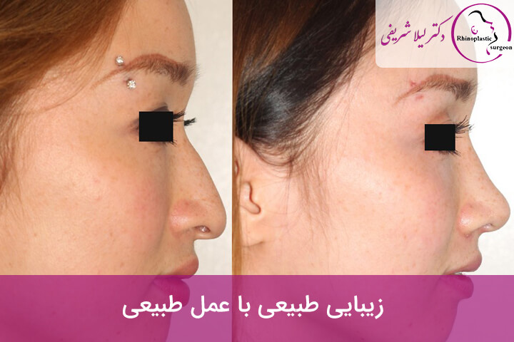 زیبایی طبیعی با عمل طبیعی