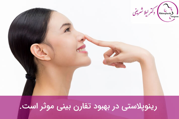 تاثیر رینوپلاستی در بهبود تقارن بینی