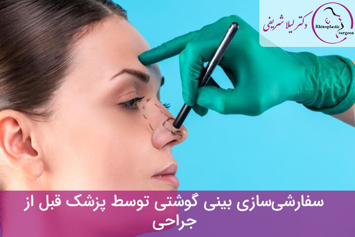 سفارشیسازی بینی گوشتی