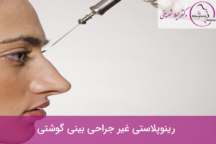رینوپلاستی غیر جراحی بینی گوشتی