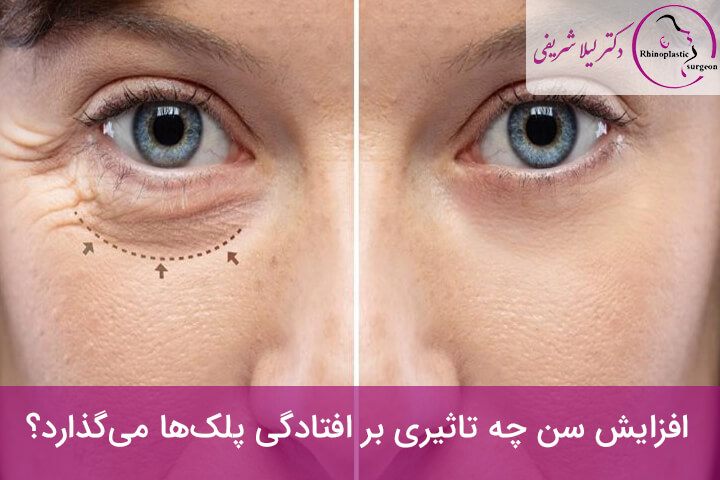 عمل پلک چشم