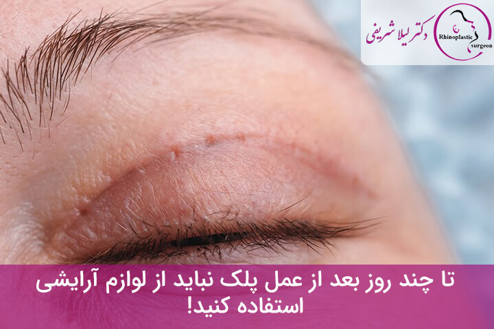 آرایش بعد از عمل پلک