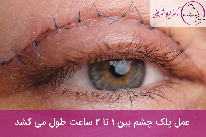 روش جراحی Blepharoplasty