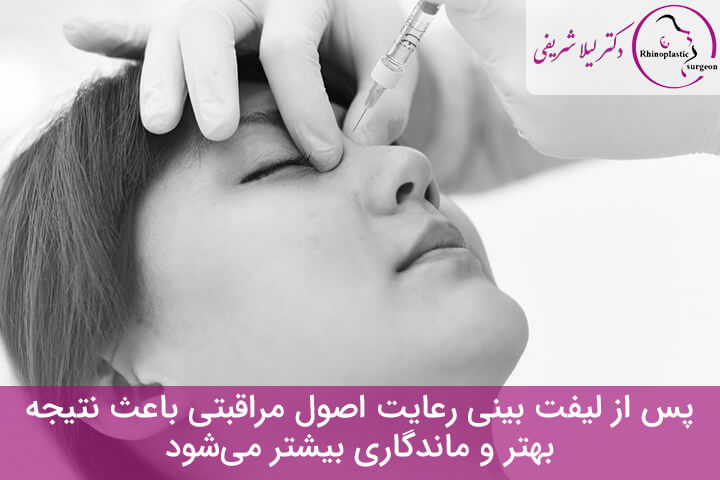 مراقبت های پس از لیفت بینی