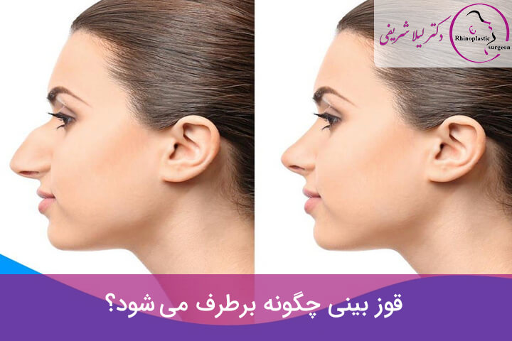 مشخصات بینی استخوانی