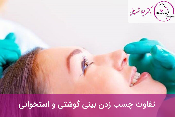 تفاوت چسب زدن بینی گوشتی و استخوانی
