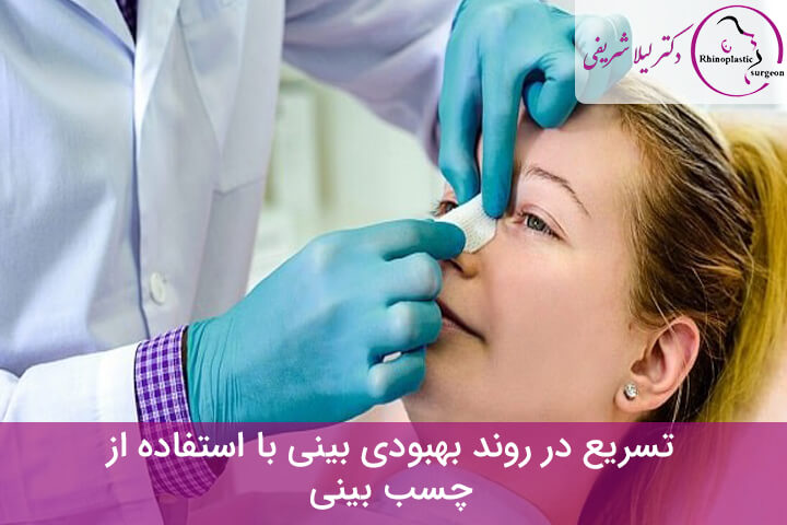 آموزش طریقه چسب زدن بینی گوشتی