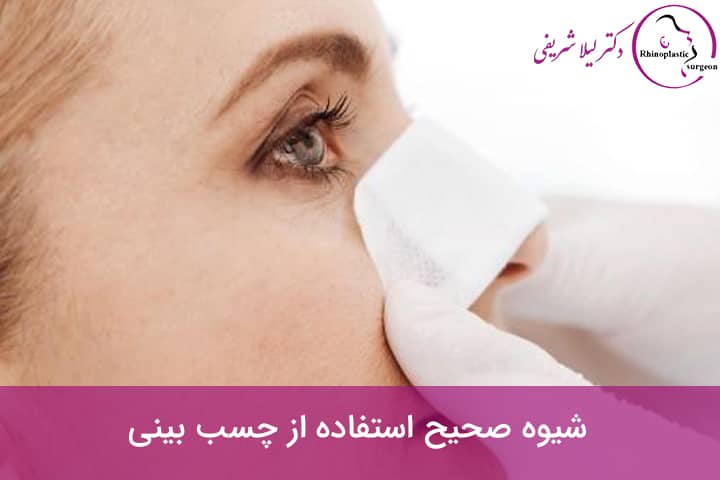 استفاده از چسب بینی بعد از عمل