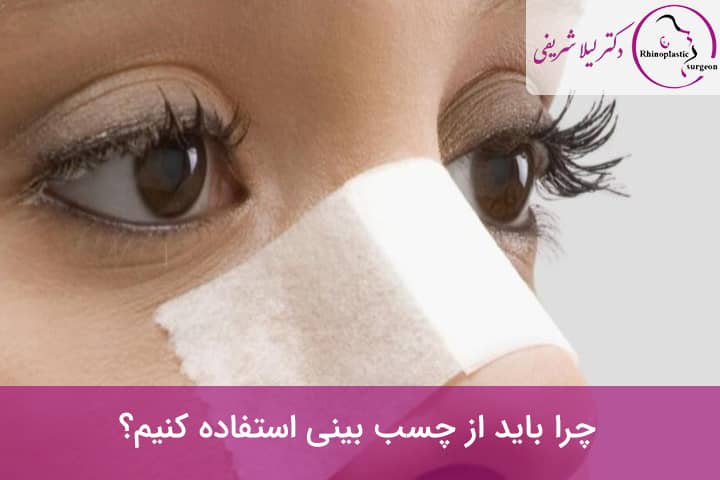 استفاده از چسب بینی برای کاهش تورم