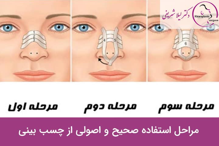 طریقه چسب زدن بینی گوشتی