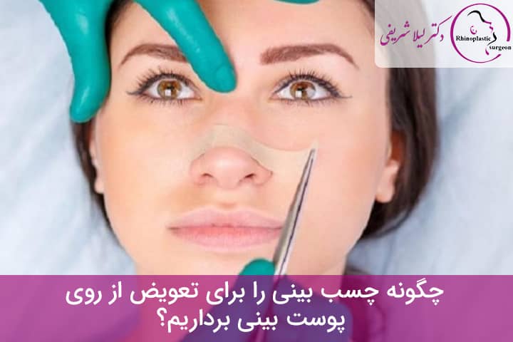 برداشتن چسب بینی