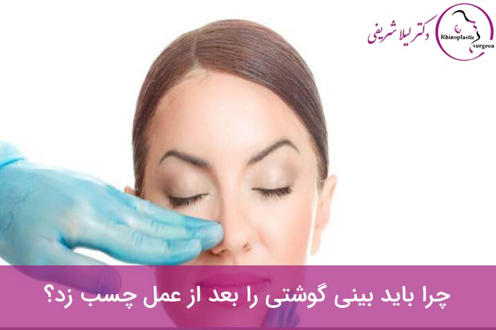مزایای چسب زدن بینی گوشتی