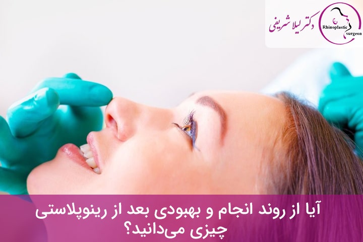 رینوپلاستی چیست؟
