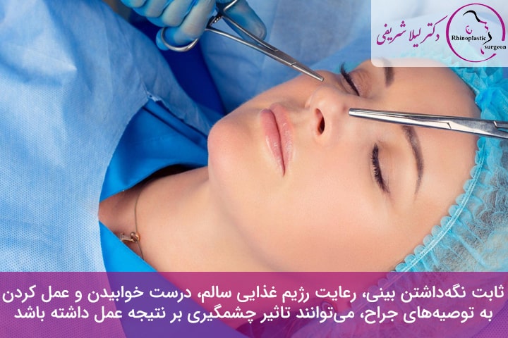 حرف زدن بعد از رینوپلاستی