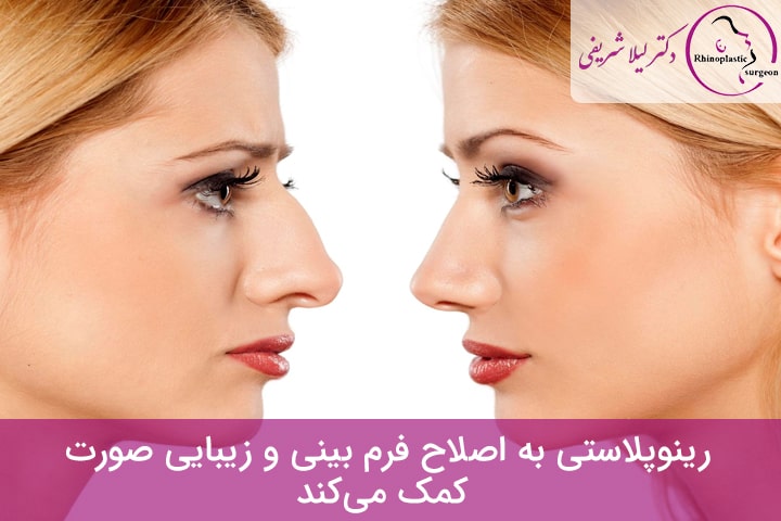 جدیدترین روش رینوپلاستی