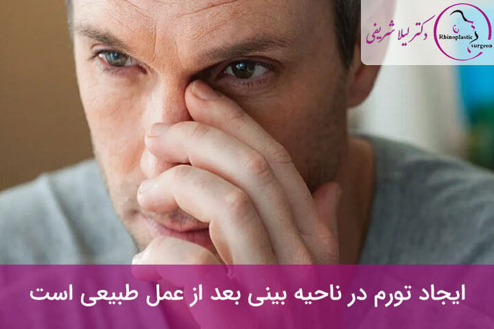 ورم بینی بعد از عمل