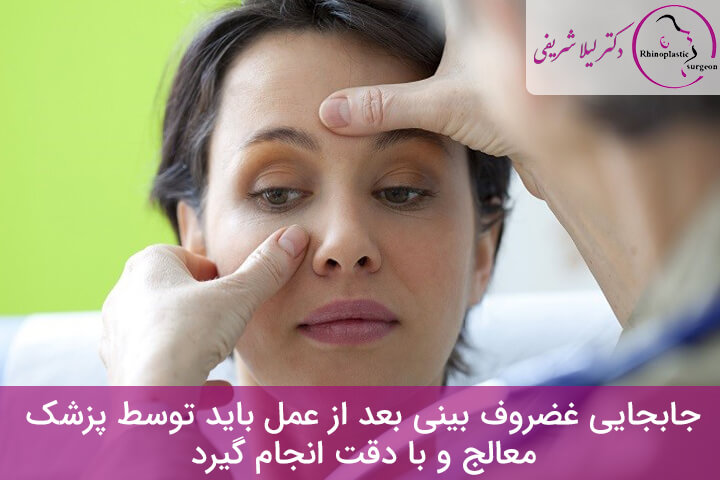 تشخیص جابجایی غضروف بینی