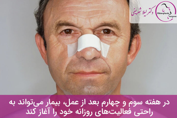 زمان جوش خوردن غضروف بینی