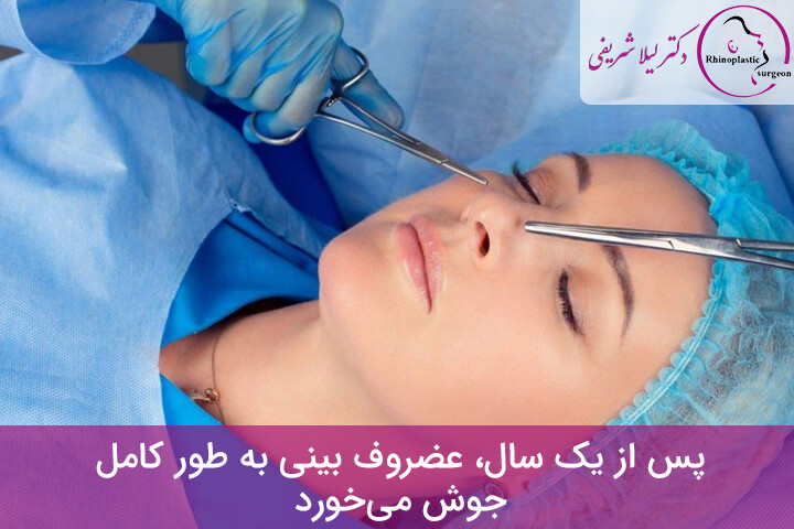 جابجایی غضروف بینی