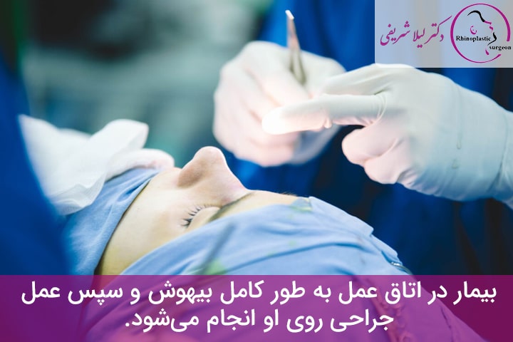 استفاده از روش بسته برای جراحی بینی