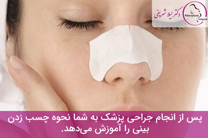چسب زدن بینی گوشتی