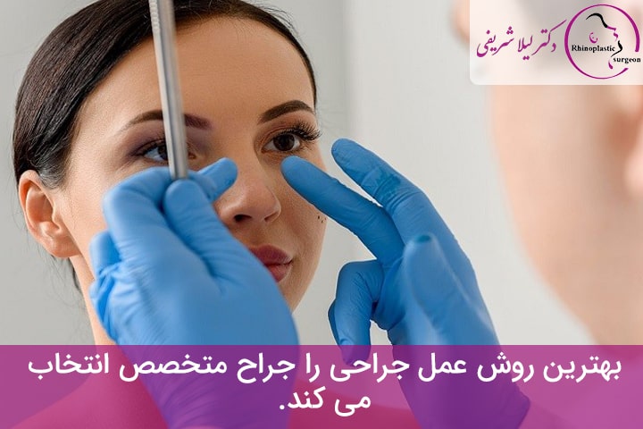 مزایای استفاده از روش بسته برای جراحی بینی گوشتی