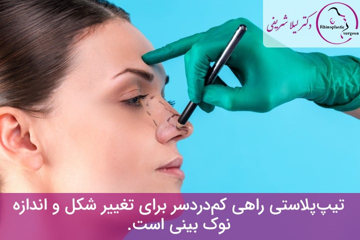 هزینه تیپ پلاستی بینی