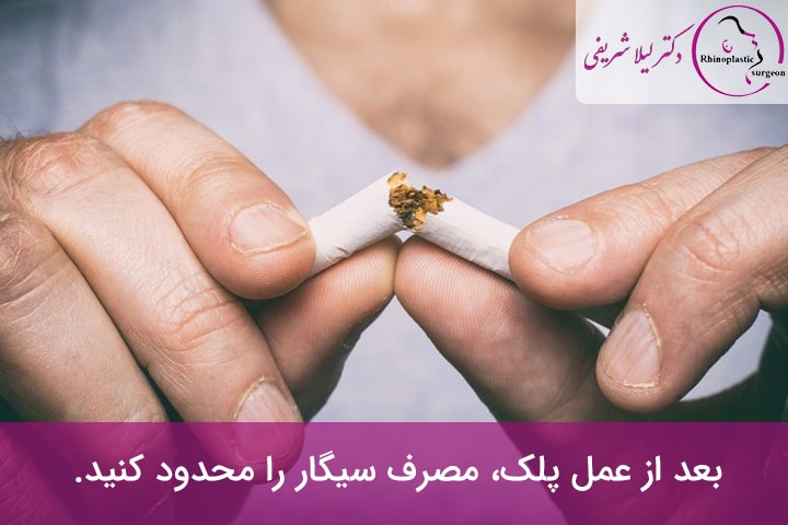 مراقبت های بعد از بلفاروپلاستی