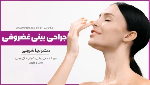 جراحی بینی غضروفی